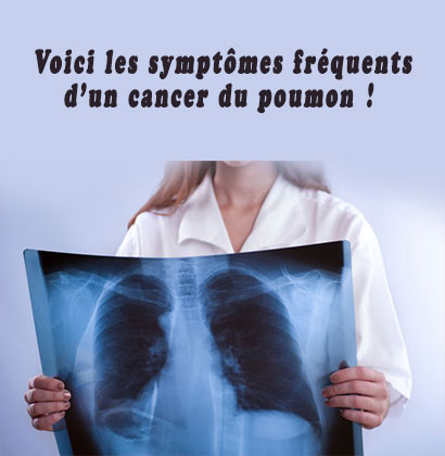 Voici les symptômes fréquents d’un cancer du poumon ! Voici les symptômes fréquents d’un cancer du poumon !