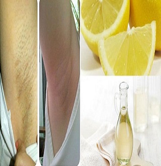 Le citron Comment blanchir les aisselles noircies ?