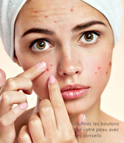 Oubliez les boutons sur votre peau Oubliez les boutons sur votre peau avec ces conseils