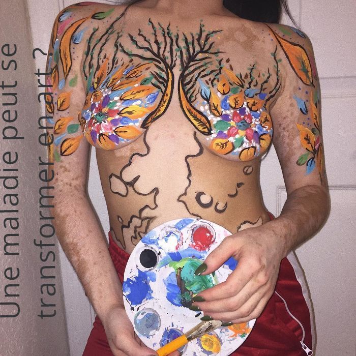 Une maladie peut se transformer en art ?