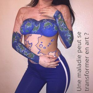 Une maladie peut se transformer en art ?