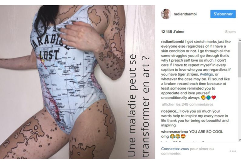 Une maladie peut se transformer en art ?