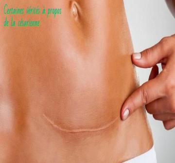 Selon de nombreuses personnes, les femmes qui accouchent par césarienne sont paresseuses et veulent tout simplement éviter les douleurs de l'accouchement.