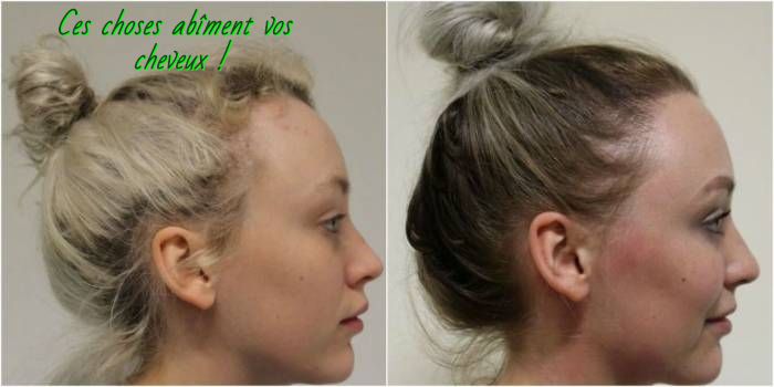 Ces choses abîment vos cheveux Ces choses abîment vos cheveux