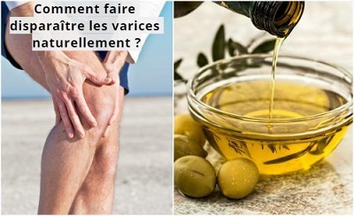 Comment faire disparaître les varices naturellement ?