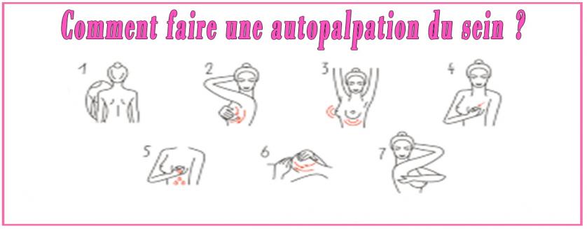 Comment faire une autopalpation du sein ?