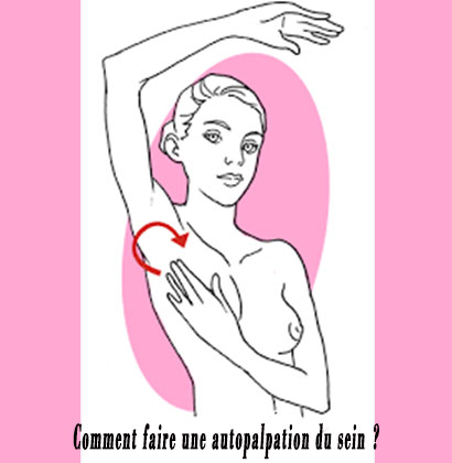 Comment faire une autopalpation du sein ?