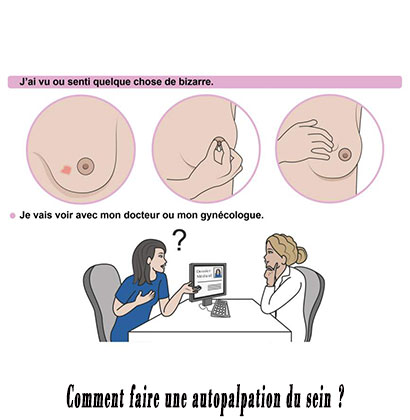 Comment faire une autopalpation du sein ?