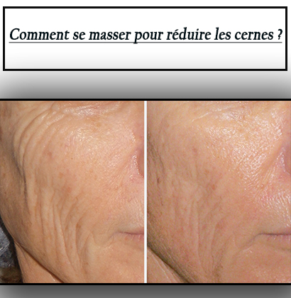 Comment se masser pour réduire les cernes ?