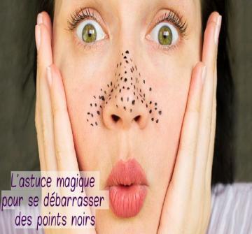 Les solutions naturelles pour éliminer les points noirs facilement.