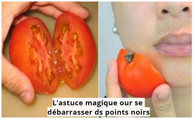 L'astuce magique pour se débarrasser des points noirs