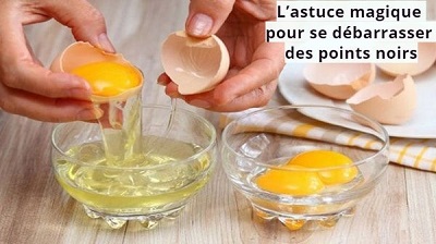 L'astuce magique pour se débarrasser des points noirs