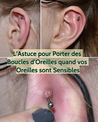 L’Astuce pour Porter des Boucles d’Oreilles quand vos Oreilles sont Sensibles 