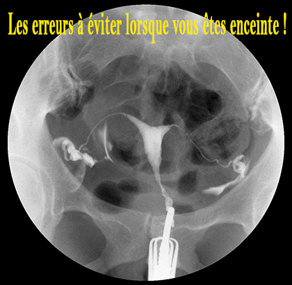 Les erreurs à éviter lorsque vous êtes enceinte !