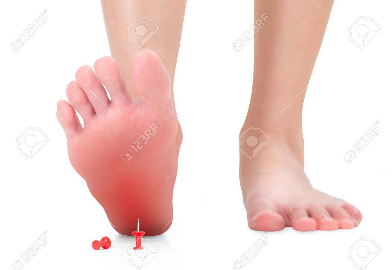 Maux au niveau de la fourche Mesdames: Les talons hauts sont dangereux pour la santé!