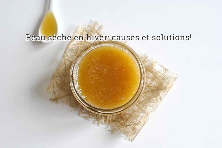 Les causes et les solutions pour une peau sèche Peau sèche en hiver: causes et solutions!