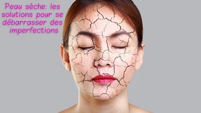 Peau sèche: les solutions pour se débarrasser des imperfections