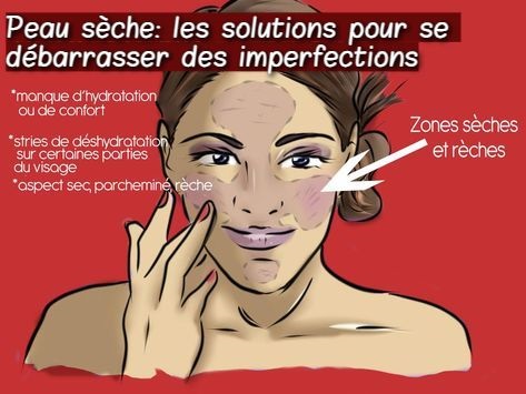 Peau sèche: les solutions pour se débarrasser des imperfections