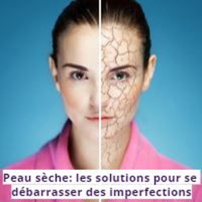 Peau sèche: les solutions pour se débarrasser des imperfections