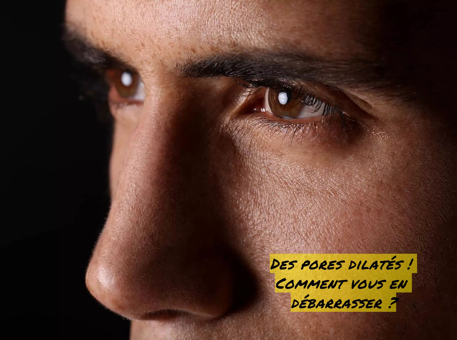Les pores dilatés Des pores dilatés ! Comment vous en débarrasser ?