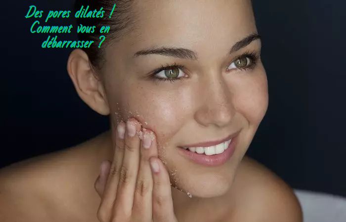 Essayez un peeling Des pores dilatés ! Comment vous en débarrasser ?