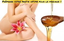 Épilation avant le mariage conseils pour prendre soins de votre partie intime