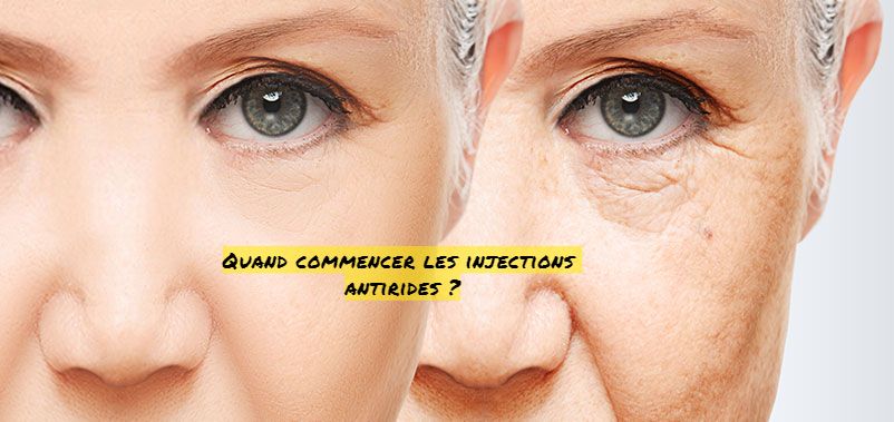 Les injections antirides Quand commencer les injections antirides ?