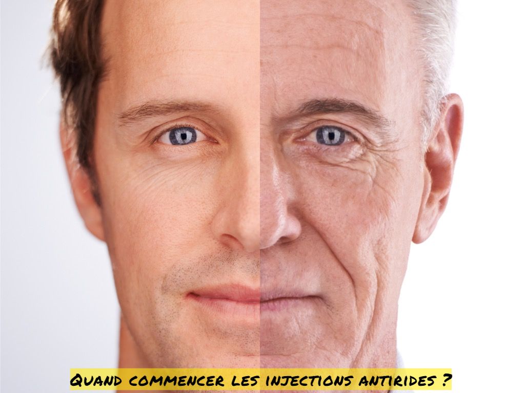 Quand commencer les injections antirides Quand commencer les injections antirides ?
