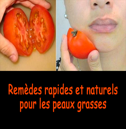 Remèdes rapides et naturels pour les peaux grasses 