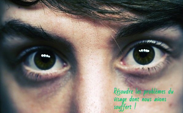 Les cernes sous les yeux Résoudre les problèmes du visage dont nous avons souffert