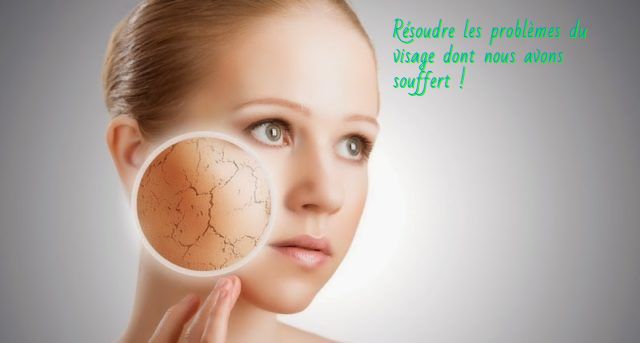 La peau sèche Résoudre les problèmes du visage dont nous avons souffert