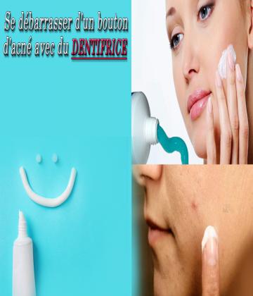 Cet article va vous montrer comment vous débarrasser d'un bouton ou du moins le rendre plus discret avec un peu de pâte dentifrice.