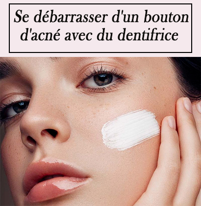 Se débarrasser d'un bouton d'acné avec du dentifrice