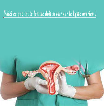 Voici ce que toute femme doit savoir sur le kyste ovarien !